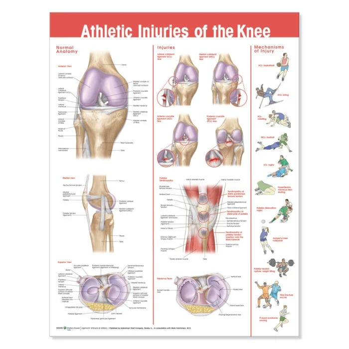 Athletic Injuries Of The Knee Chart 3 Athletic Injuries Of The Knee Chart