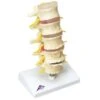 Anatomical Spine Model -Medical Rehabilitation Products 081658913 md